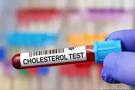 同样是高血脂，为什么甘油三酯容易降，胆固醇却很难。图片