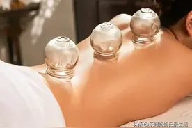 我是一名小儿推拿师:第一次感受这么舒服的拔罐图片