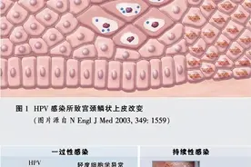 宫颈癌治愈率揭秘：早期发现，治愈率高达95%！图片