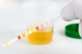 晨尿泡沫多白天却无，是肾在向你求救?图片