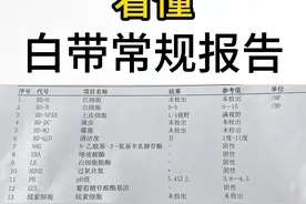 30秒教你看懂白带常规报告图片