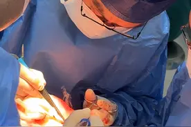 女子隆鼻致鼻部溃烂，4次手术修复终于还原容貌图片