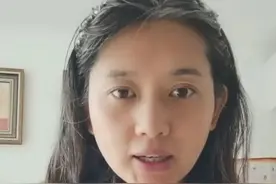 心酸！内蒙古37岁美女满头白发吐槽：我们家族的遗传基因太强大了图片