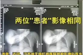 CT片惊人雷同，医生硬核举报！无锡医院陷骗保风波，官方将揭真相图片