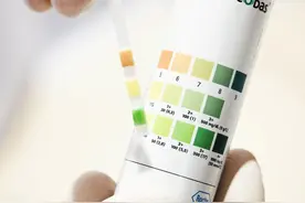 尿液像水一样清澈，才代表正常？医生提醒：这6种颜色要小心图片