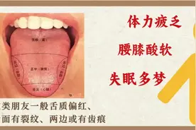 肝好肾才强！3个中成药益精血、补肝肾，筋骨强了，眼睛也亮了！图片