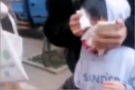 江西8岁男童遭狗扑咬，脸上缝了90多针！母亲：孩子几乎毁容图片