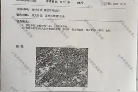 一男子阑尾炎手术15个月后在体内发现纱布，当地医调委已介入图片