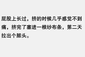 看看这些狠人是怎么处理火疖子的图片