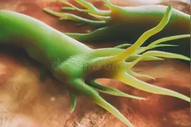 口苦口臭，幽门螺旋杆菌却是阴性，是胃的问题还是胆的问题？图片