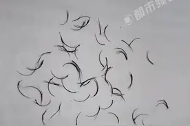 女生眼角掉出黑色异物竟是74根眼睫毛图片