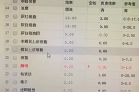 尿检中未分类结晶体升高是怎么回事？图片