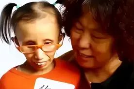 5岁女童如80岁老太，医生称活不过14岁，她说：妈妈，生弟弟救我图片