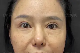 一棍子打醒做大拉皮的人！图片