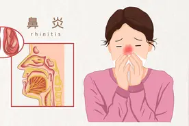 过敏性鼻炎的特效方——小青龙汤！打喷嚏、流鼻涕皆可用！图片