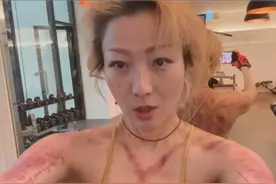 53岁郑秀文刮痧浑身通红，仍疯狂健身！瘦到皮包骨自律让人佩服！图片