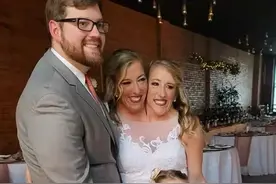 共享身体的双头姐妹中的一个结婚，网友对他们婚姻生活有很多疑问图片