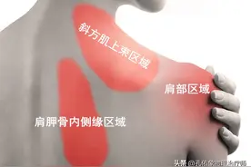 手麻、肩胛骨缝疼痛，是颈椎病吗？一文详细告知您常见的3大病因图片