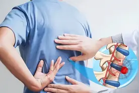 两个习惯，让我的腰椎间盘一直没有复发过，突友们加油！图片