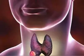 长出了甲状腺结节的人，背后或有4个原因，希望能尽早了解图片