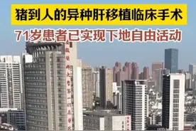 我国完成全球首例猪肝移植活体人手术，转基因猪肝移植到肝癌重症患者身上图片