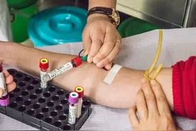 为啥一到医院就要抽血？医生揭秘：抽出来的血，最终都去了哪里图片