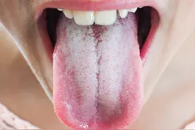 秋冬季节治疗感冒要选对药图片