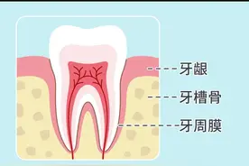 洗牙会伤牙吗？破除大误区，科学护齿从定期洁牙开始图片