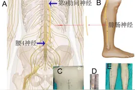西安交大二附院：为截瘫患者重燃行走希望图片