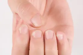 身体有啥病，指甲先知道！出现这4种颜色变化，小心为妙图片