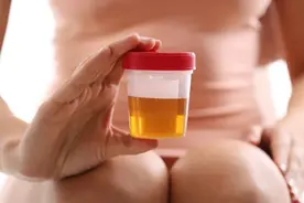 尿里有泡沫，是因为肾不好还是其他疾病？图片