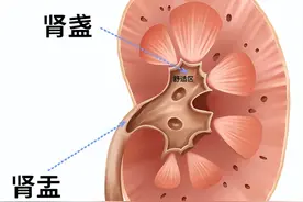 今日泌尿系结石知识分享：不同位置的泌尿结石发作到底有多痛？图片