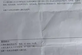 彩超4a，不痛不痒的肿块竟然是乳腺癌！我懵了！图片
