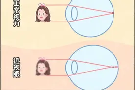 孩子近视了到底要不要戴眼镜？图片