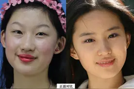19岁少女执意整成“刘亦菲”，连名字也高仿，8年后她现状怎样？图片