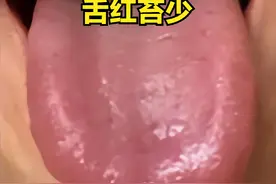 六味地黄丸、桂附地黄丸、五子衍宗丸谁才是补肾王者？舌象告诉你图片