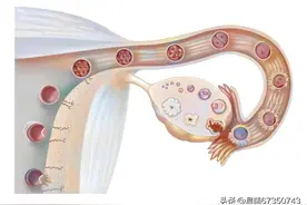 认识卵巢癌图片