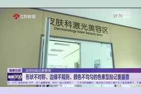 小心!这些部位的胎记易癌变应尽早切除图片