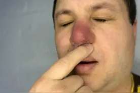 经常挖鼻子的孩子，迟早要自食3种“恶果”，趁他们还小赶紧阻止图片