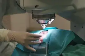 我做了激光近视手术二十年后的状况图片