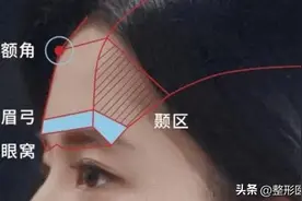 天生额头窄小、扁平，2mm膨体填进去，大胆露额头也很美图片