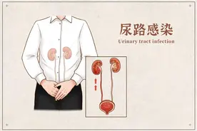 男性尿路感染：症状、预防与治疗，一篇文章全搞定！图片