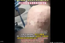 2个裸体男童遭虐打 背上全是伤痕！打人者身份曝光，网友炸锅！图片