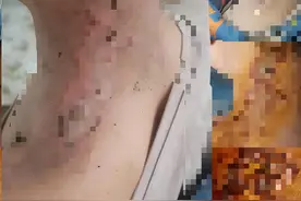男童玩烟花落进低龄小孩脖子致烧伤 双方家属起争执 律师：无论男童是否故意 监护人都应当承担全部责任！图片