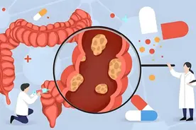 时而便秘，时而腹泻？可能是癌症信号！图片