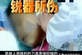 惊爆！广东六岁女童手指耳朵被剁掉，行凶之人你绝对想不到！图片