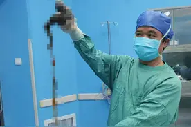 9岁女孩腹痛呕吐，医生一看：胃里全是它图片