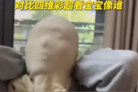 准爸妈用衣服蒙住脸 对比宝宝的四维彩超看长得像谁图片