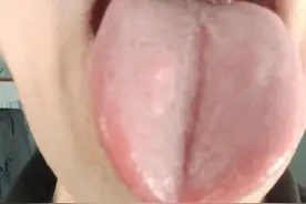 舌中间有裂纹？多是这3大病因，今天一次给你讲清楚，别再瞎折腾图片