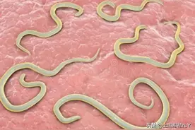 蛔虫：从童年阴影到现代都市传说图片